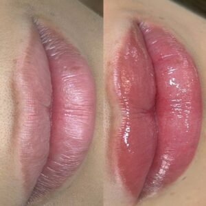 Lip Blush First Session - Image 6