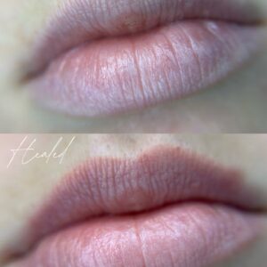 Lip Blush First Session - Image 4