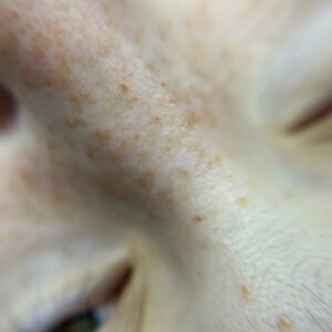 Freckles First Session - Image 4