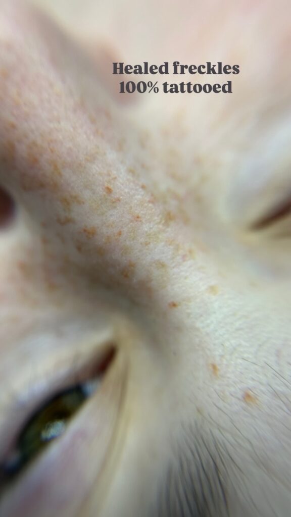 Freckles First Session