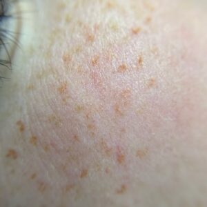 Freckles First Session - Image 5