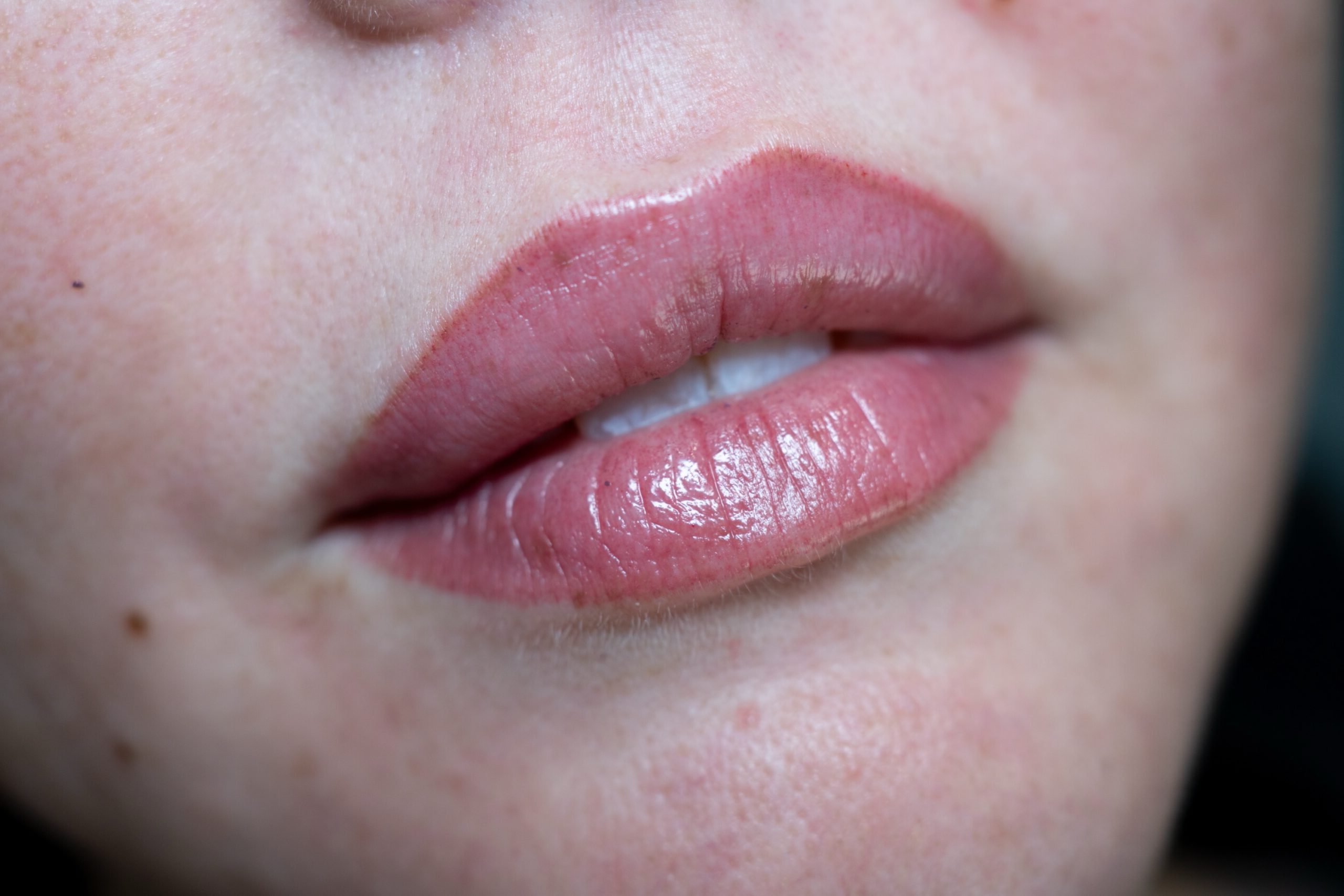 Lip Blush First Session - Image 12