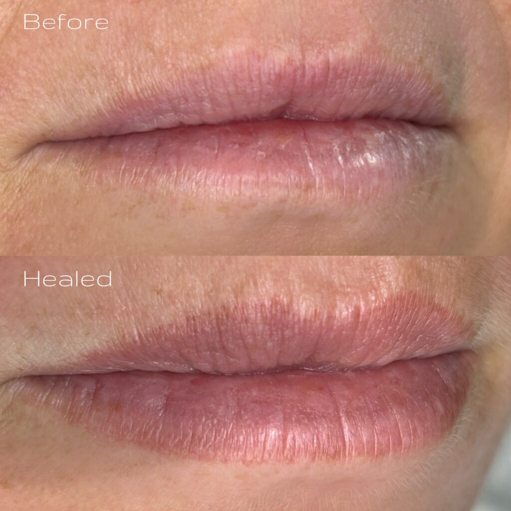 Lip Blush First Session