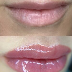 Lip Blush First Session - Image 5