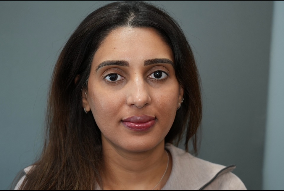 Dark Lip Neutralization First Session - Image 1