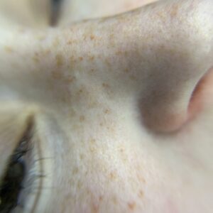 Freckles First Session - Image 2