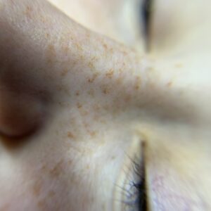 Freckles First Session - Image 3