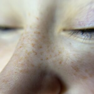 Freckles First Session - Image 3